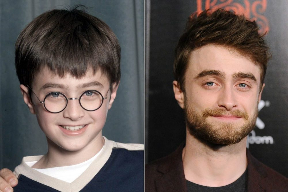 Radcliffe ngày ấy và bây giờ