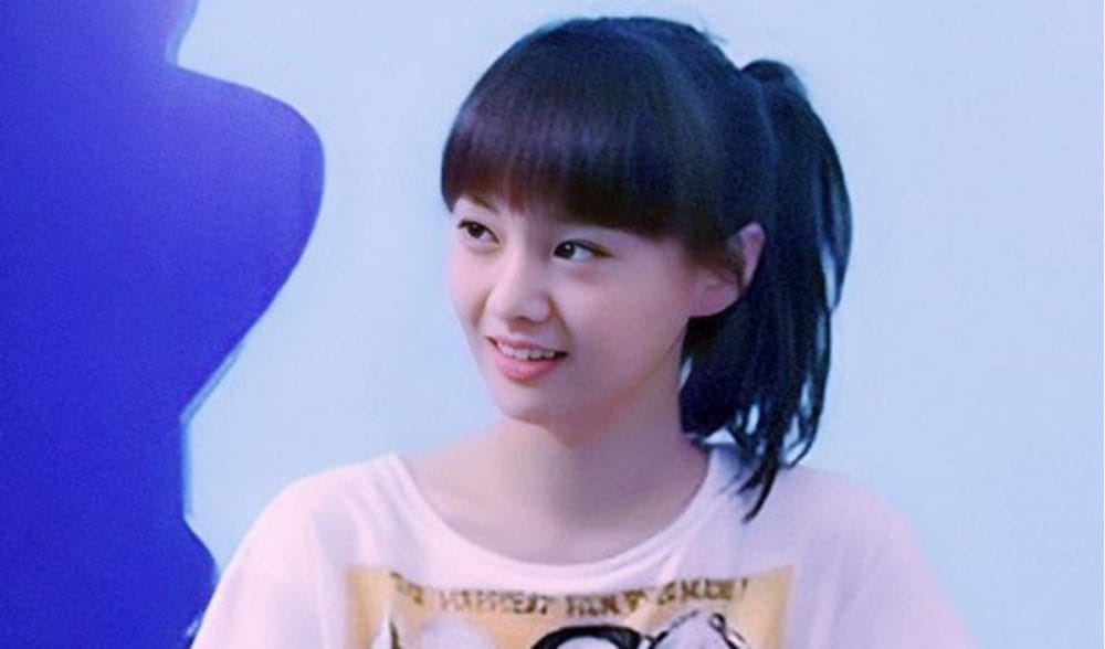 Hình ảnh nữ diễn viên trước khi phẫu thuật thẩm mỹ.