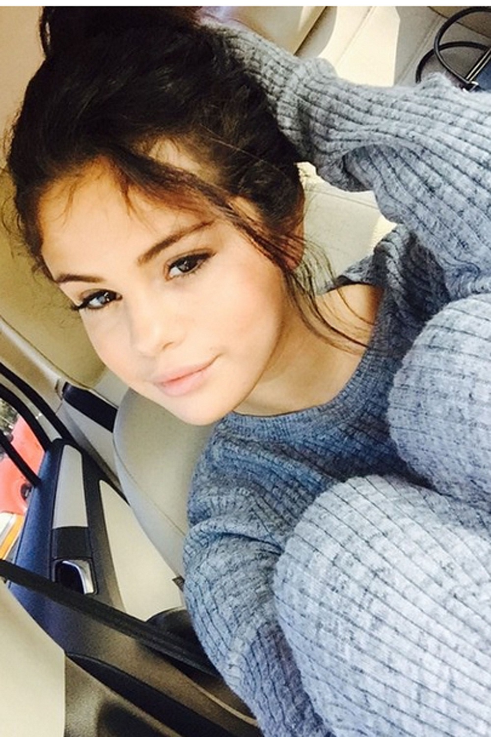 Chẩn đoán mắc bệnh Lupus và ảnh hưởng xấu đến sự nghiệp Selena